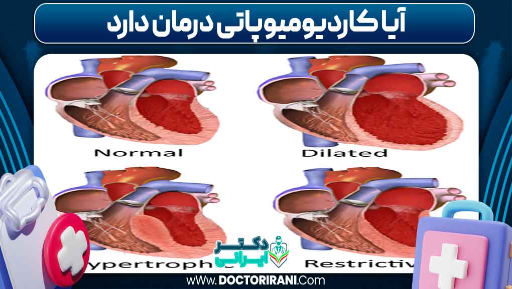 آیا کاردیومیوپاتی درمان دارد