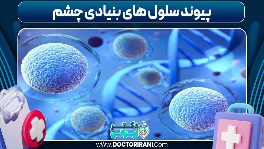 پیوند سلول های بنیادی چشم