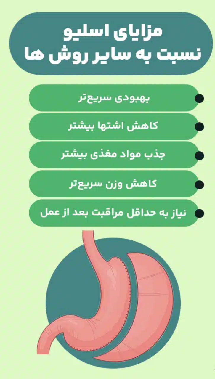 کم کاری تیروئید و عمل اسلیو معده