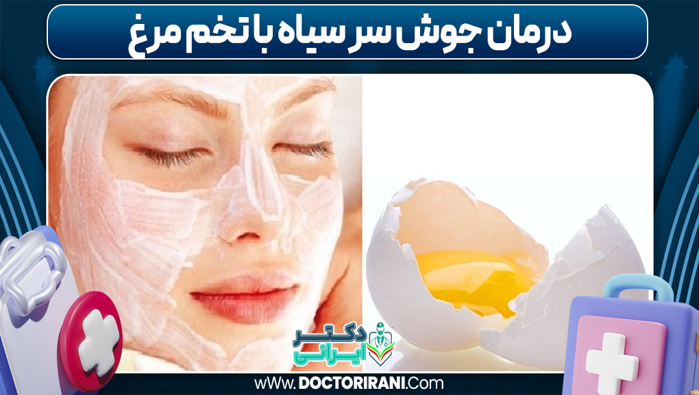 درمان جوش سر سیاه با تخم مرغ