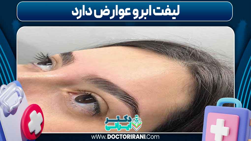 لیفت ابرو عوارض دارد