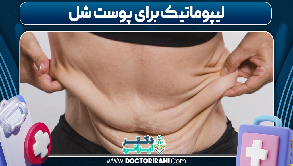 لیپوماتیک برای پوست شل