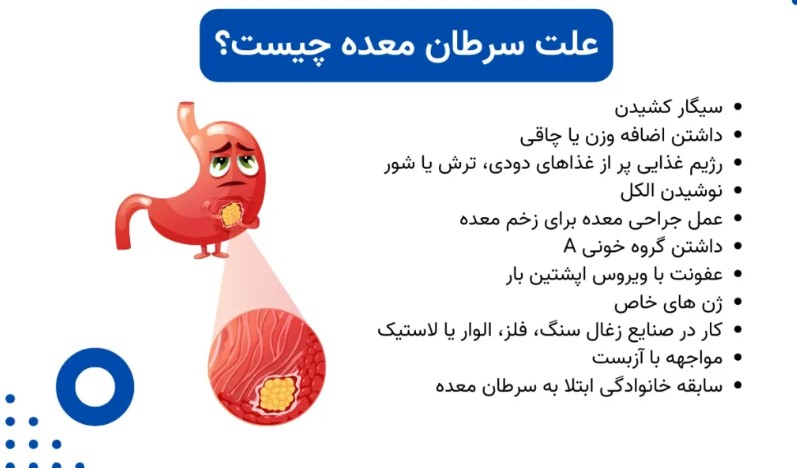 آیا رفلاکس معده باعث سرطان می‌شود