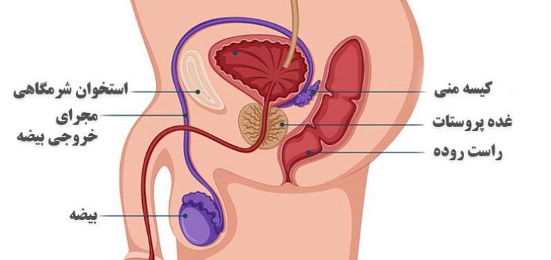 آیا سرطان پروستات باعث لاغری می‌شود