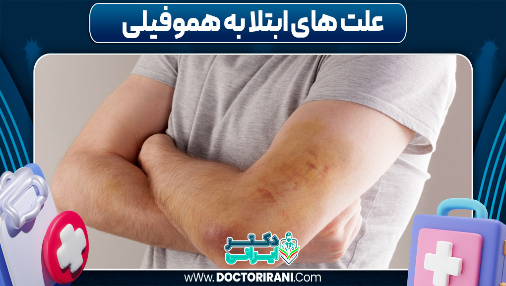 علت های ابتلا به هموفیلی