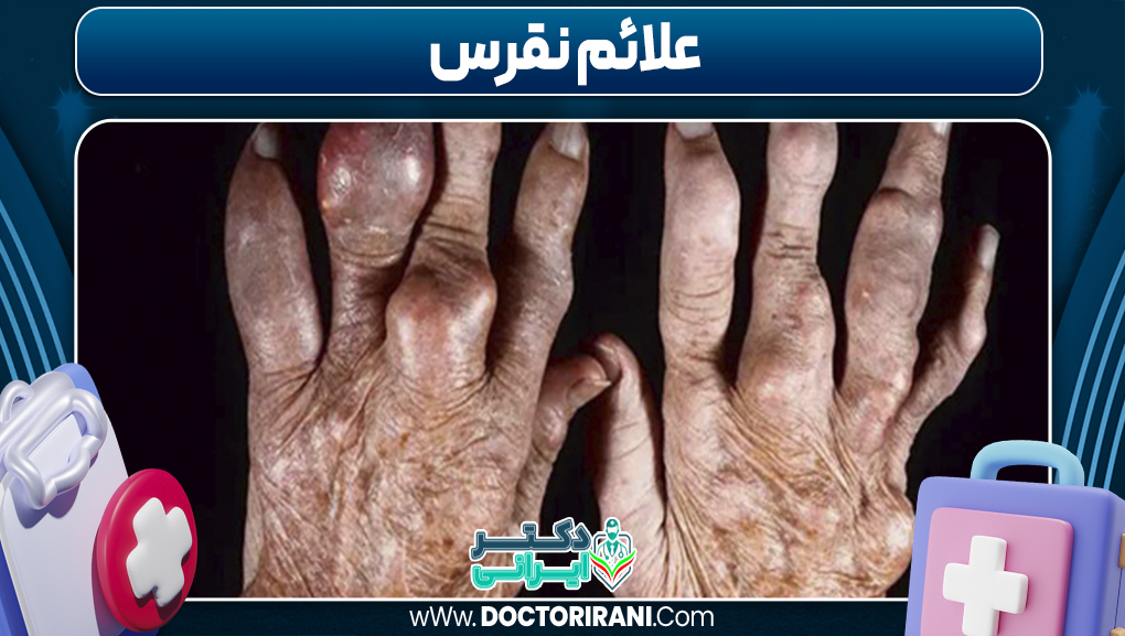 علائم نقرس 