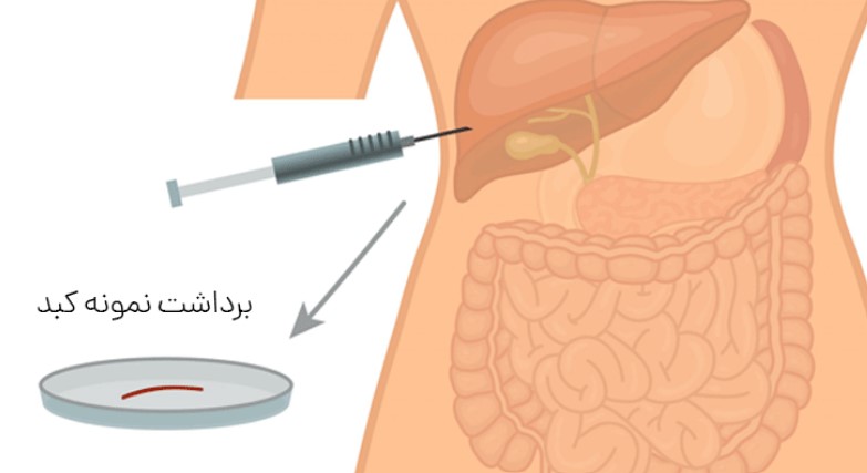 علت انجام آزمایش کبد