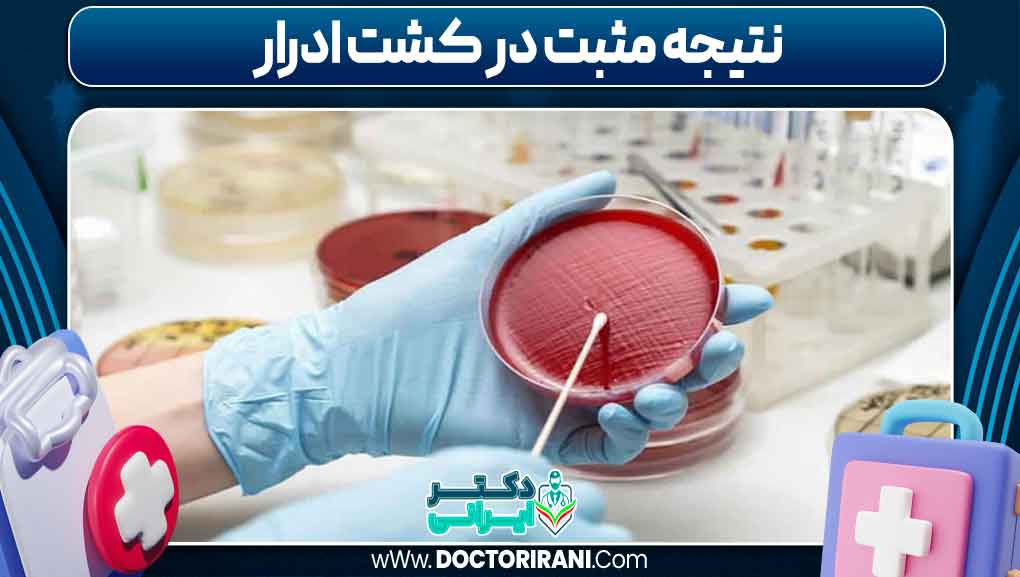 نتیجه مثبت در کشت ادرار