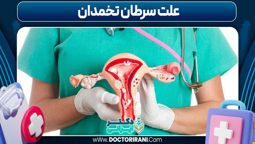 علت سرطان تخمدان