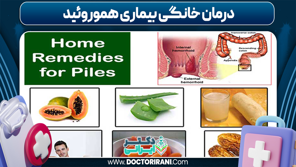 درمان خانگی بیماری هموروئید درمان خانگی بیماری هموروئید
