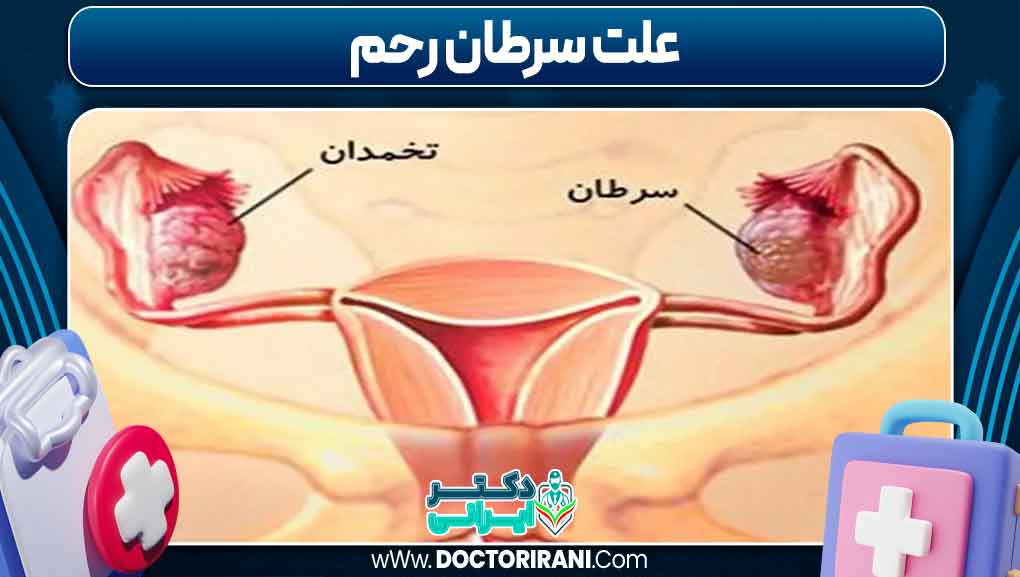 علت سرطان رحم
