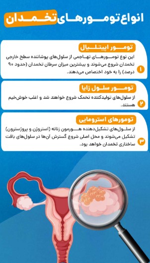 انواع سرطان تخمدان
