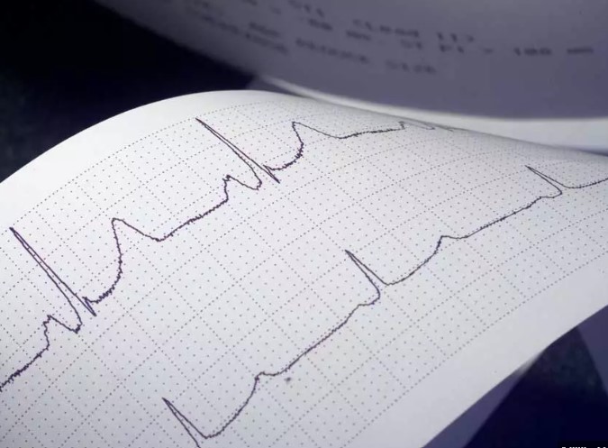 نوار قلب در بارداری