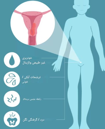 بیوپسی رحم