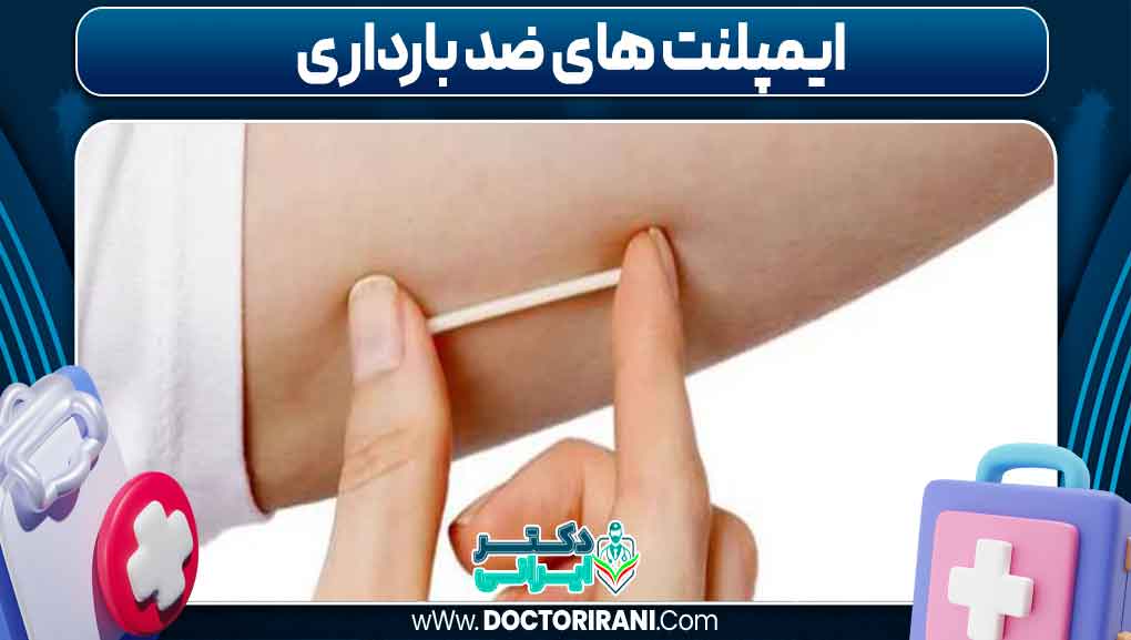 ایمپلنت های ضد بارداری