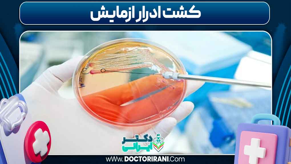 کشت ادرار آزمایش