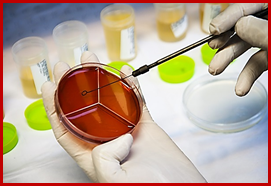 تفسیر آزمایش کشت ادرار no growth