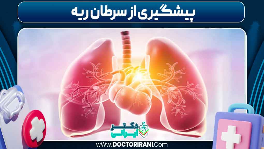 پیشگیری از سرطان ریه