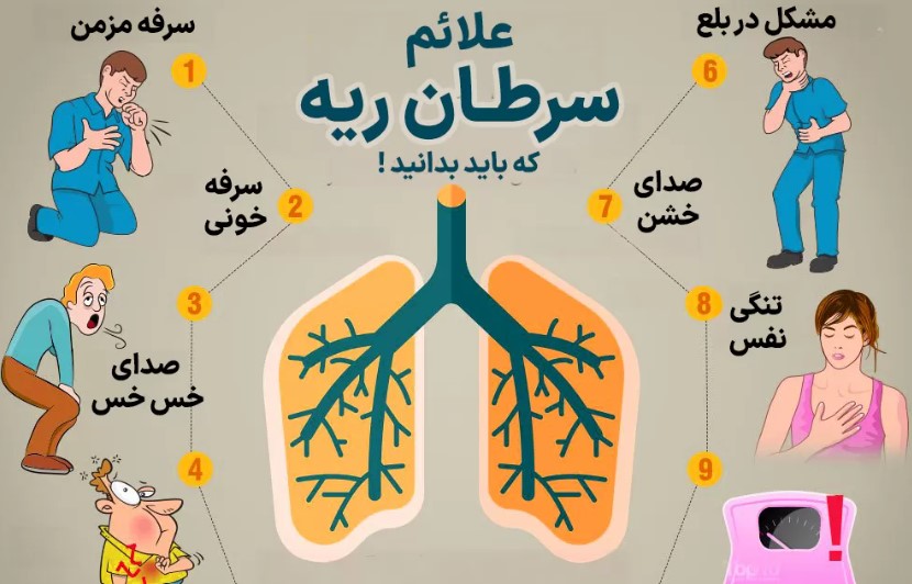 علائم سرطان ریه بدخیم چیست
