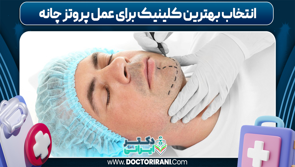 انتخاب بهترین کلینیک برای عمل پروتز چانه