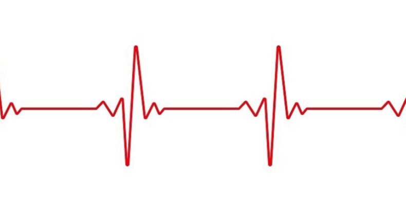 تفسیر ECG