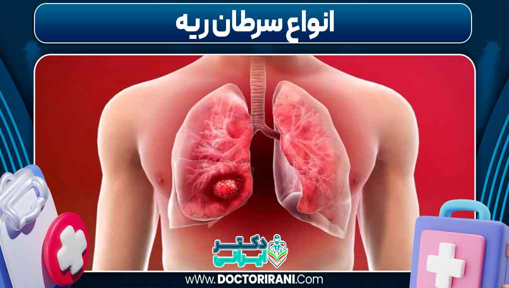 انواع سرطان ریه