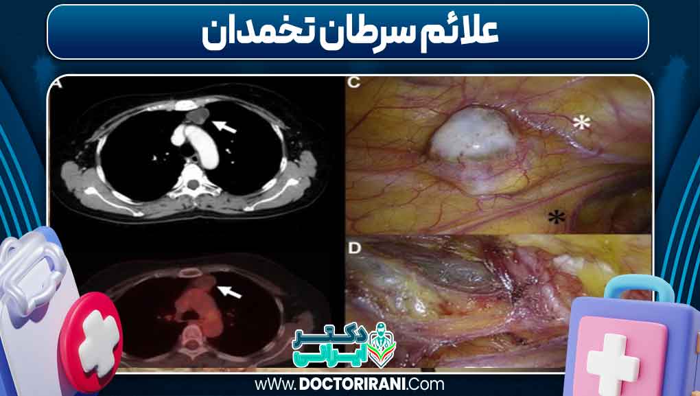 علائم سرطان تخمدان
