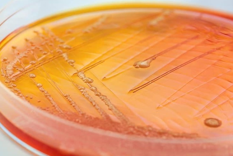 کشت ادرار در کودکان