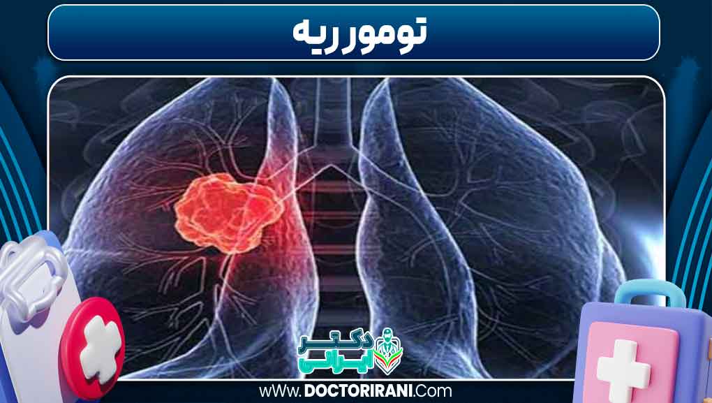 تومور ریه