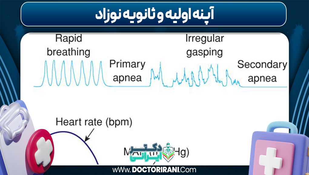 آپنه اولیه و ثانویه نوزاد