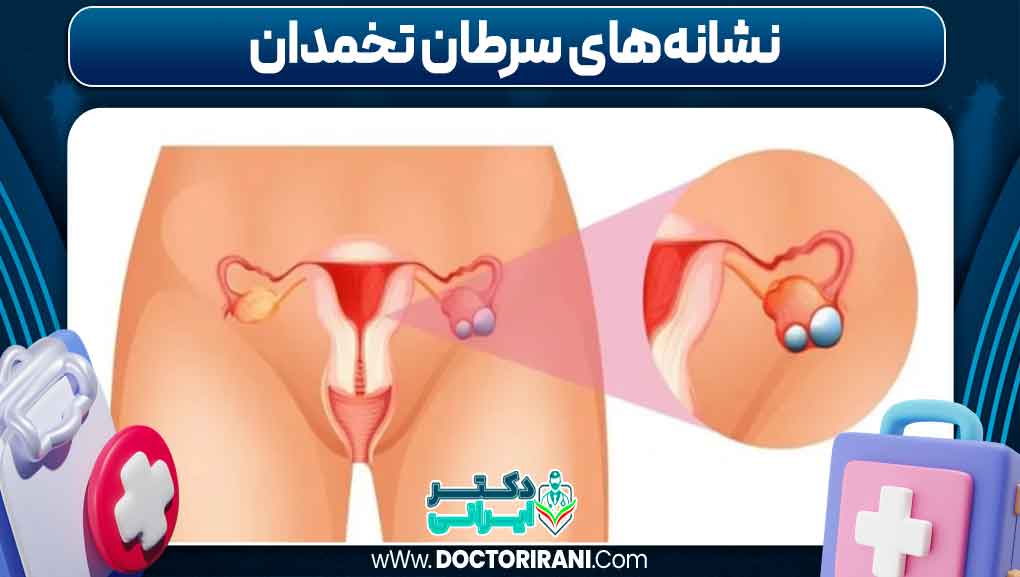 نشانه‌های سرطان تخمدان