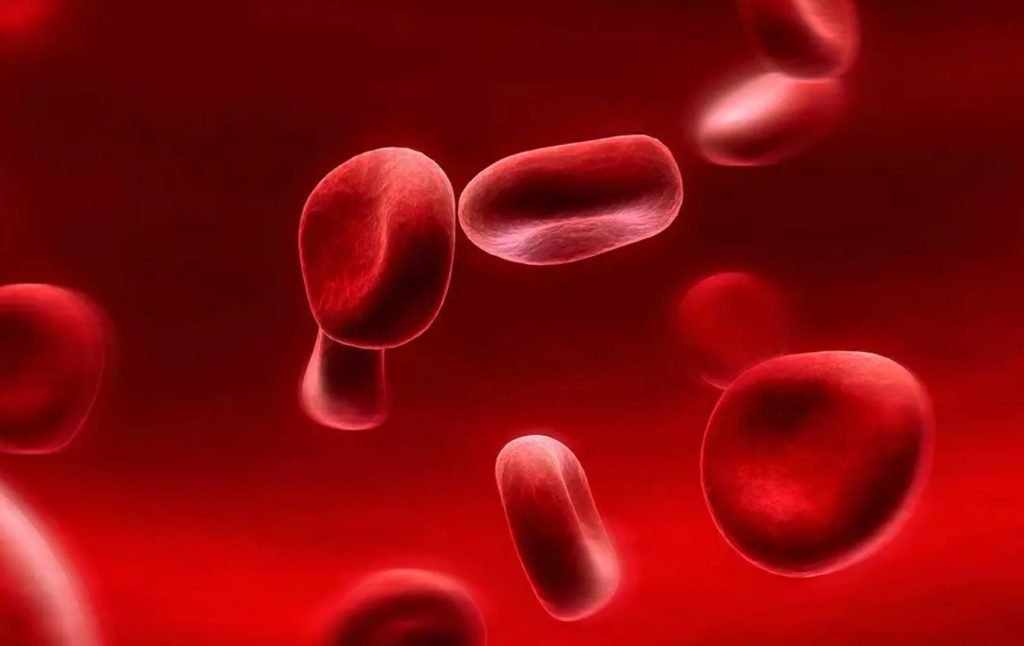 درمان سریع کم خونی شدید