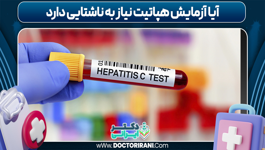 آیا آزمایش هپاتیت نیاز به ناشتایی دارد