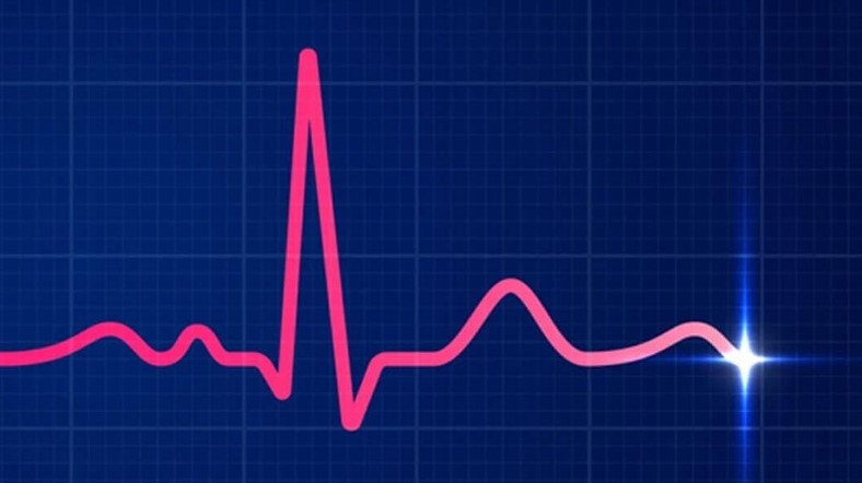 برادی‌کاردی در نوار قلب