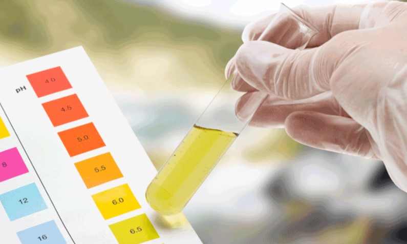 شرایط قبل از آزمایش کشت ادرار