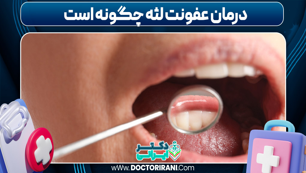 درمان عفونت لثه چگونه است