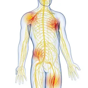 علائم بیماری نوروپاتی