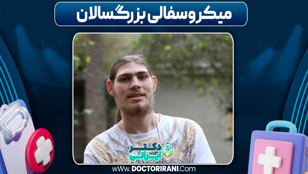 میکروسفالی بزرگسالان