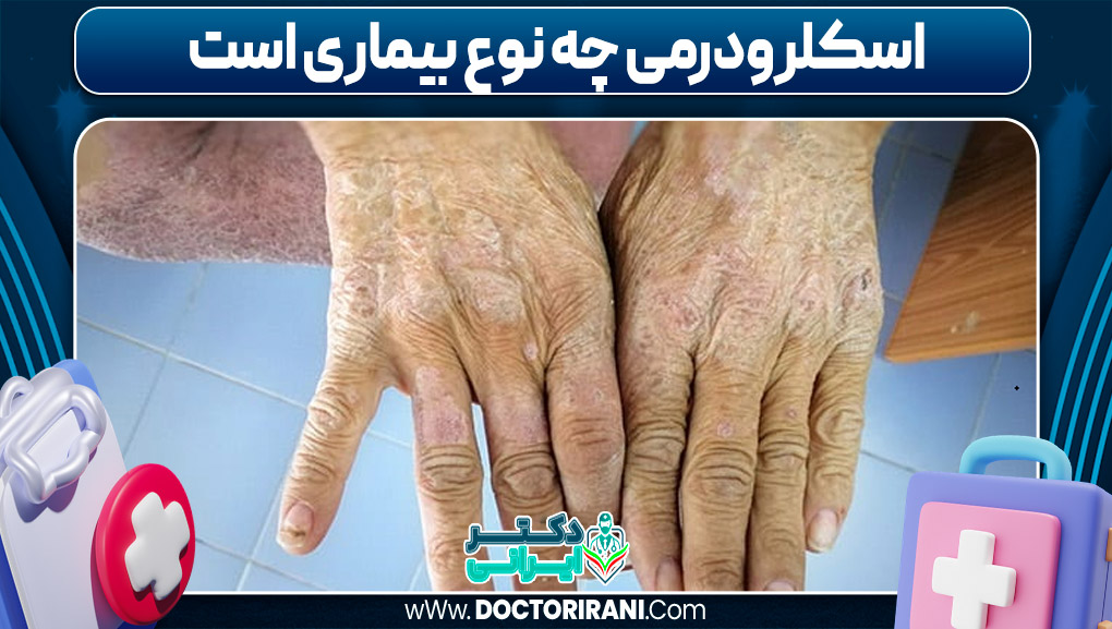 اسکلرودرمی چه نوع بیماری است