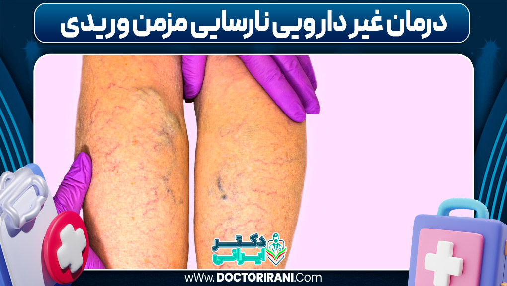 درمان غیر دارویی نارسایی مزمن وریدی