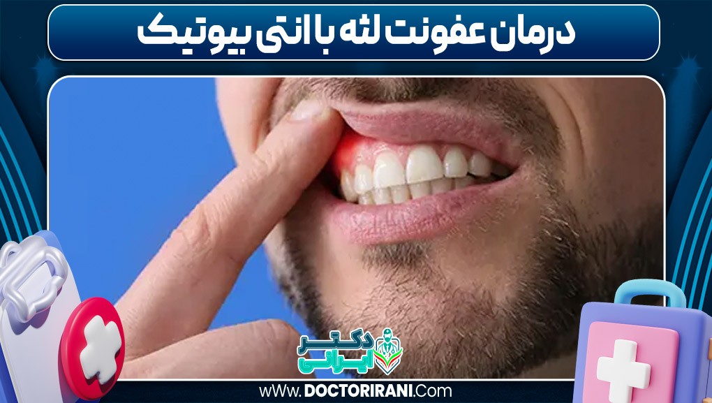 درمان عفونت لثه با انتی ‌بیوتیک